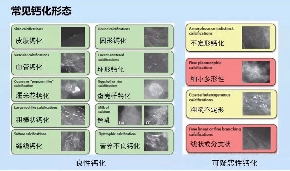 1571014410367084053.jpg 大抵wqed.jpg