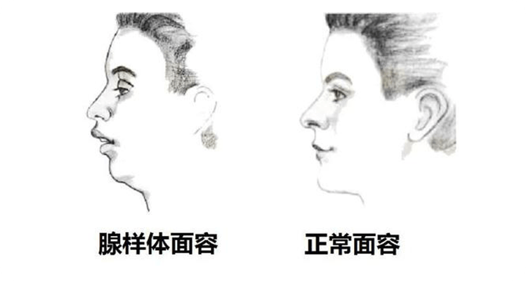 图片3.png 图片